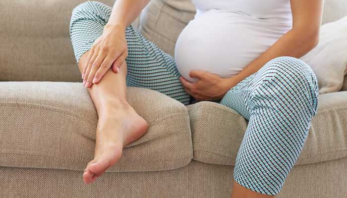 نحوه کاهش ورم بدن در دوران بارداری
